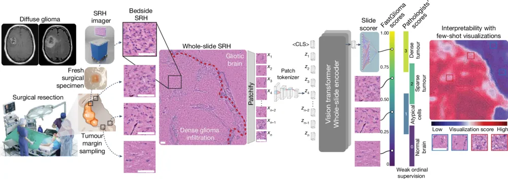 Figure from Foundation models for fast, label-free detection of glioma infiltration